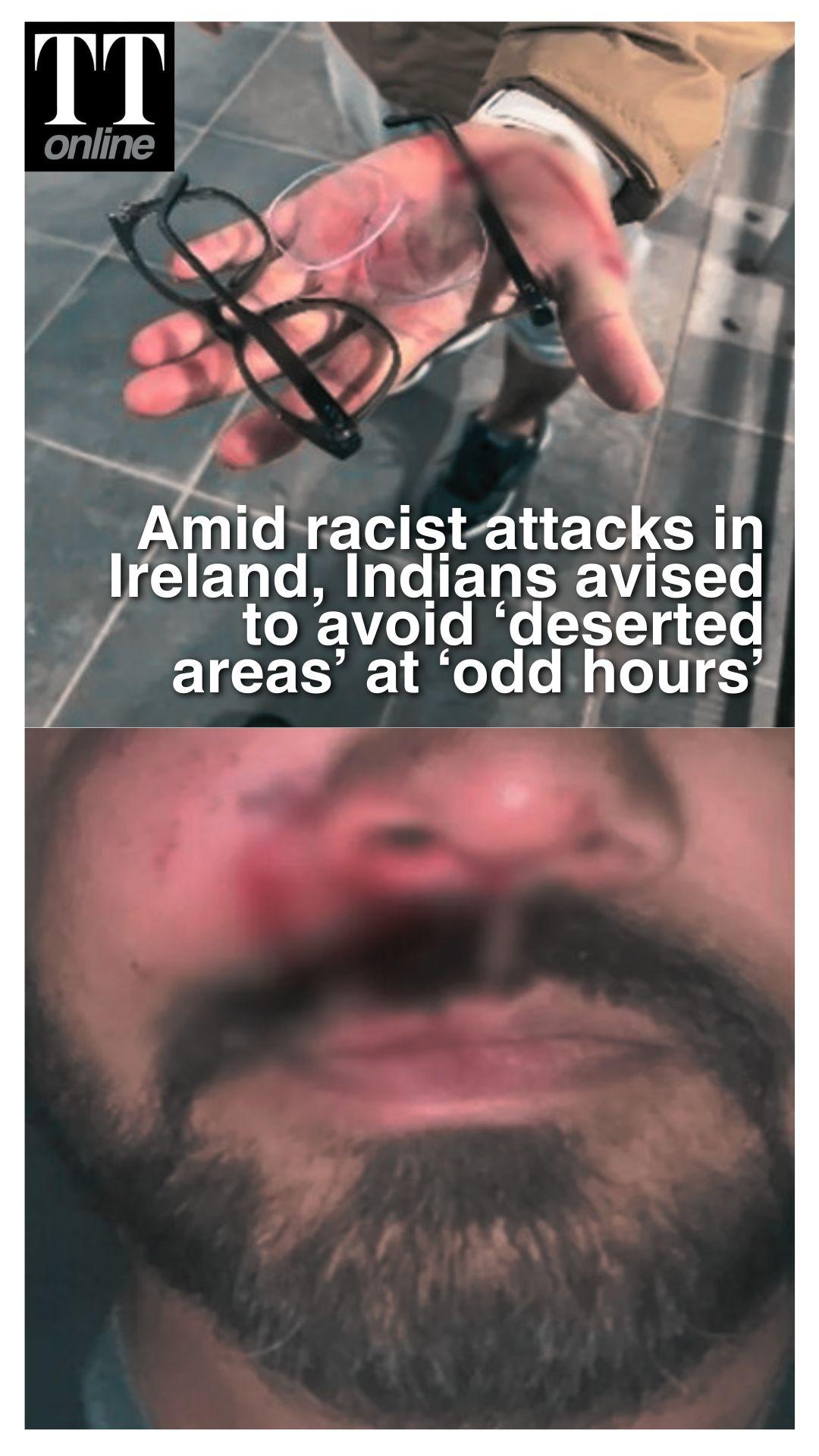 India Issues Advisory For Indians in Ireland Amid Rising Racist Attacks